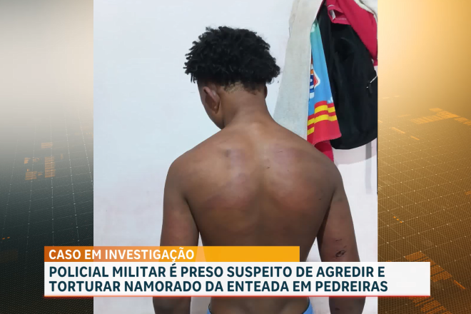 Polícia Civil investiga caso de jovem de 17 anos agredido por policial militar