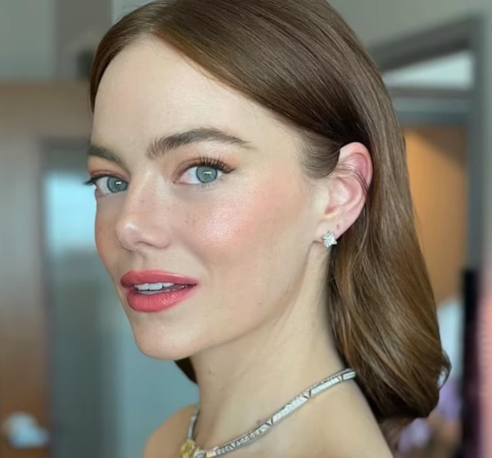 Anitta, Kris Jenner e Emma Stone: entenda o ‘novo facelift’ dos famosos