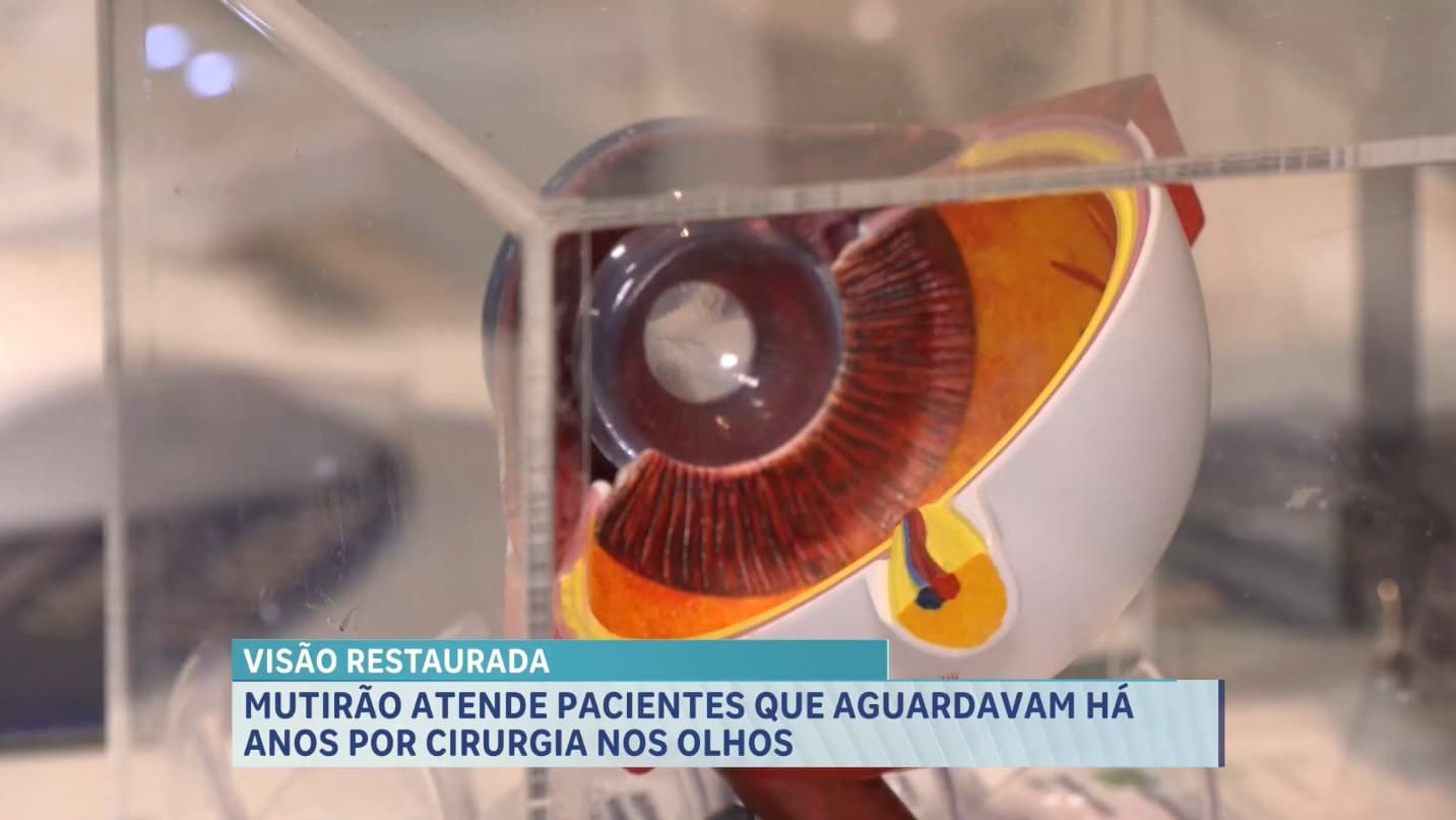 Hospital Universitário da UFMA promove mutirão de cirurgias oftalmológicas na capital