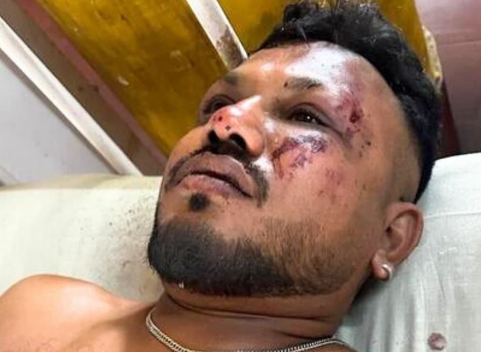 Saiba quem é o único sobrevivente da queda do avião na Índia