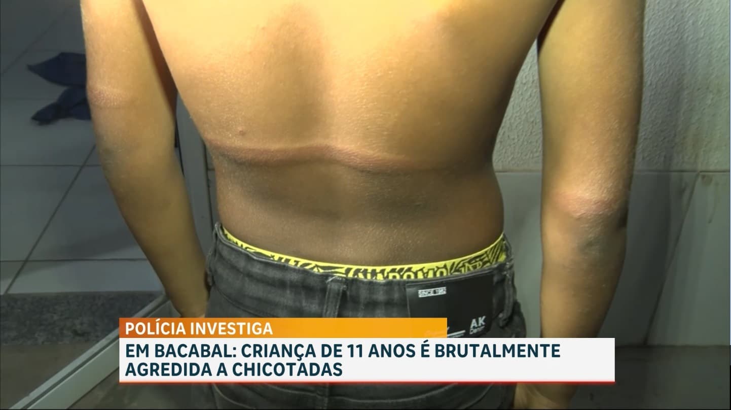 Criança de 11 anos é agredida com chicotada em Bacabal