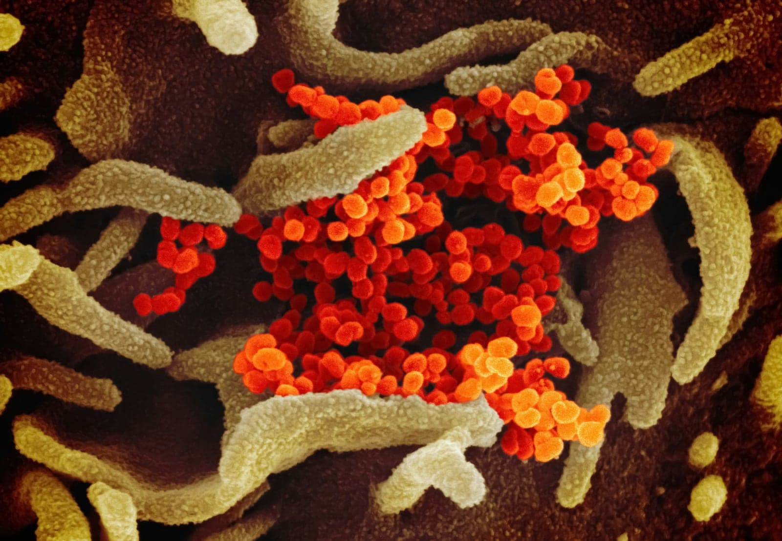 Como bactérias do intestino podem nos ajudar a dormir melhor à noite, segundo a ciência