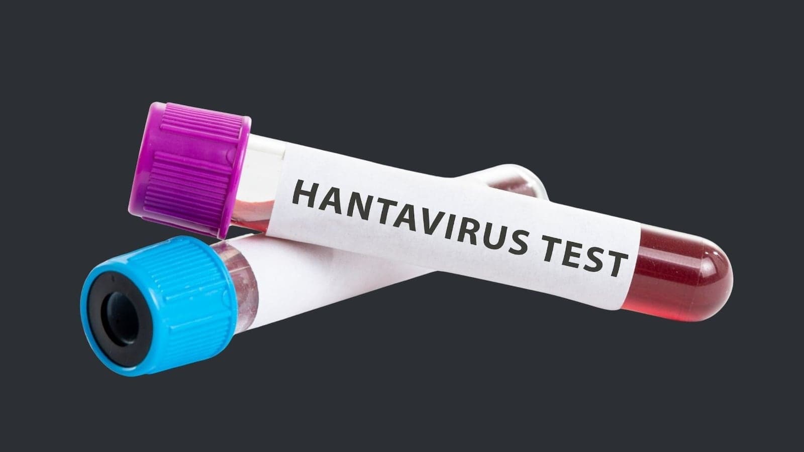 Entenda por que o hantavírus é tão letal e onde há mais risco no Brasil