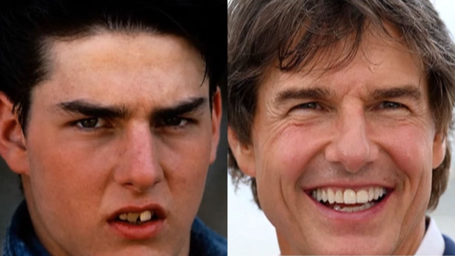 Tom Cruise, Glória Pires e Cristiano Ronaldo investiram pesado para renovar os dentes