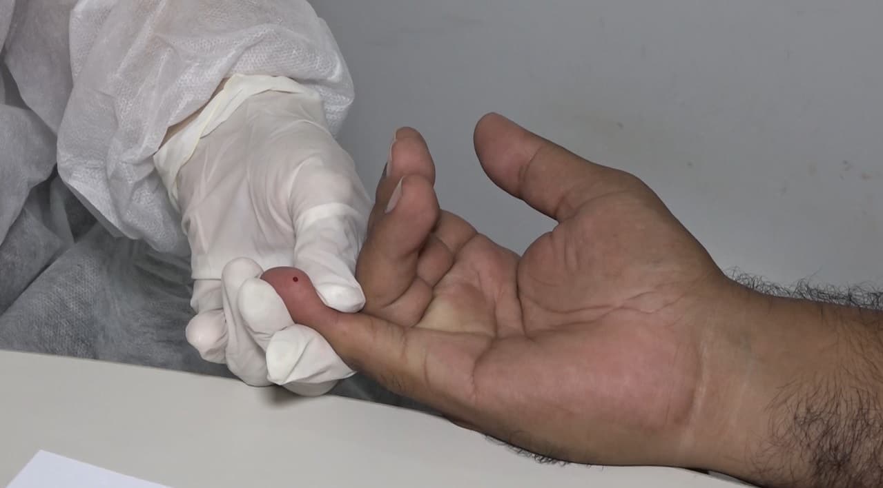 Campanha Julho Amarelo chama atenção para combate às hepatites virais no Maranhão