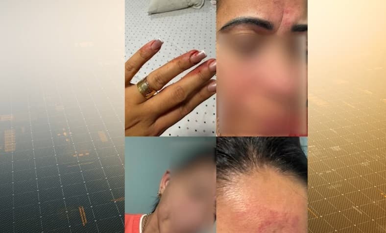 Filho denuncia suposta tentativa de feminicídio contra a mãe e pai é preso no Maranhão