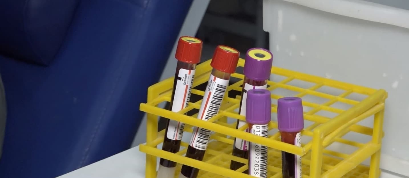 Doações de sangue caem 6% no primeiro semestre de 2026 no Maranhão