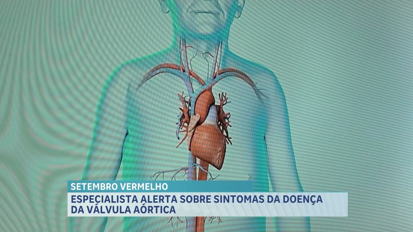 Setembro Vermelho reforça alerta sobre diagnósticos da doença da válvula aórtica